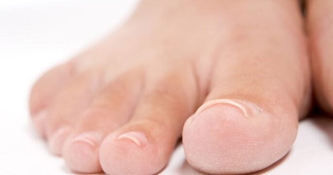 Toenails may be affected by fungal infection